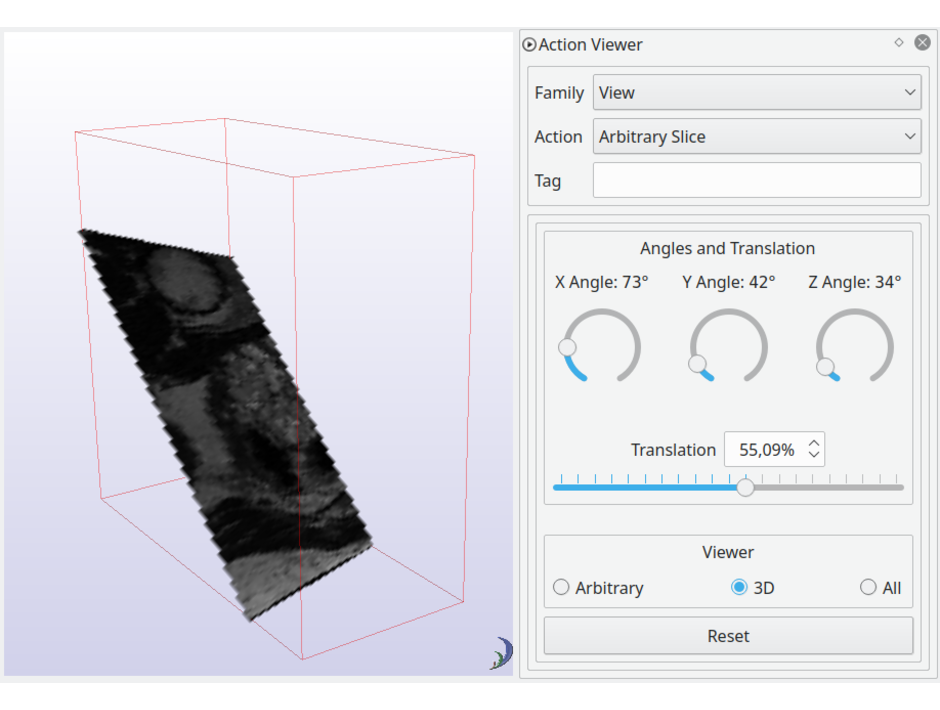 Arbitrary orientation in 3D volume