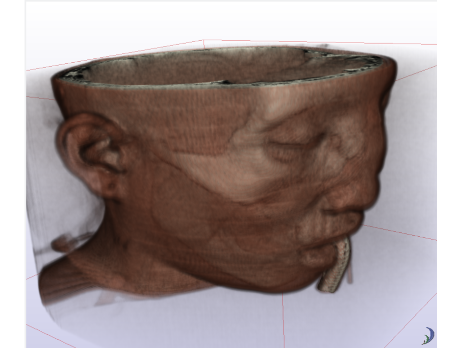 New volume rendering