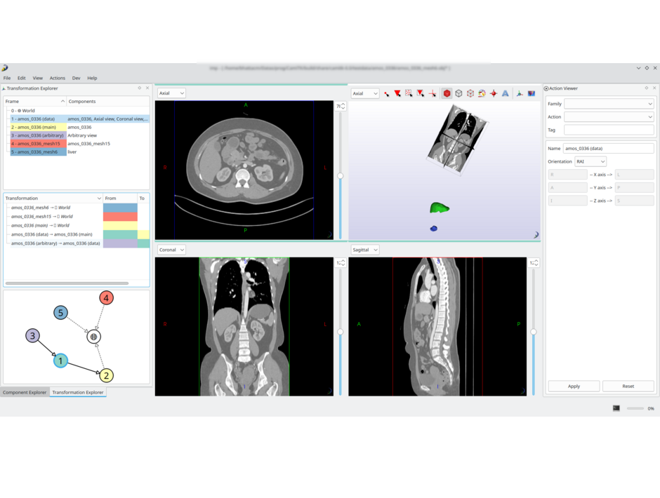 Unregistered mesh and CT image