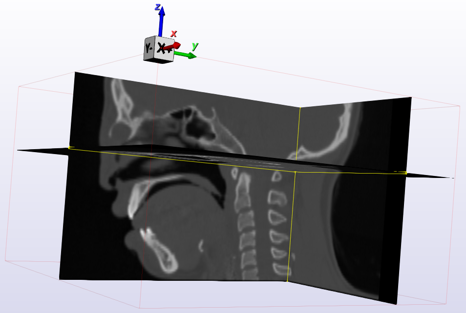 2025-07-03_TransfoManager-CTframe.png