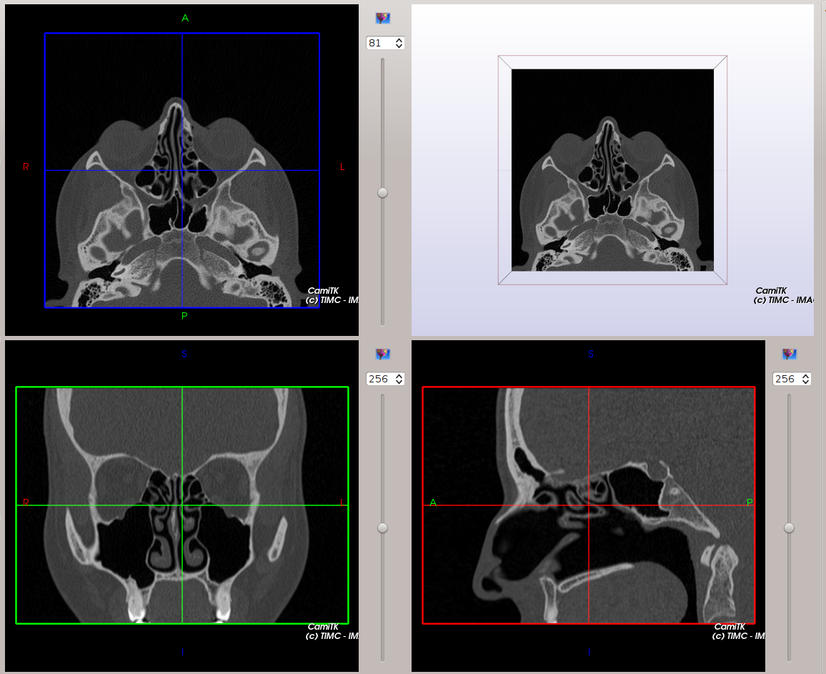 Medical_image_viewer_2.png